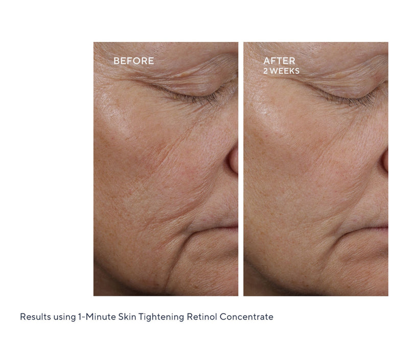 KAPLAN MD 1 Minute Skin Tightening Retinol Duo Auto-Delivery — View 5