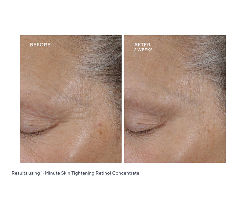 KAPLAN MD 1 Minute Skin Tightening Retinol Duo Auto-Delivery — View 4