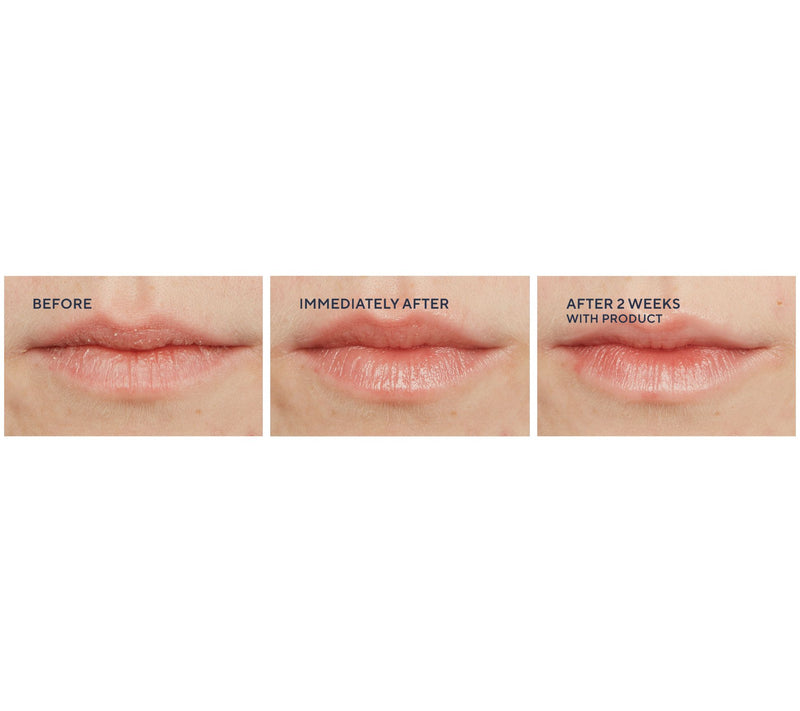 WEN by Chaz Dean Body & Lip Treatment Auto-Delivery — View 6