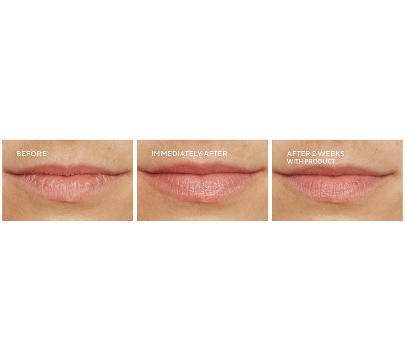 WEN by Chaz Dean Body & Lip Treatment Auto-Delivery — View 4