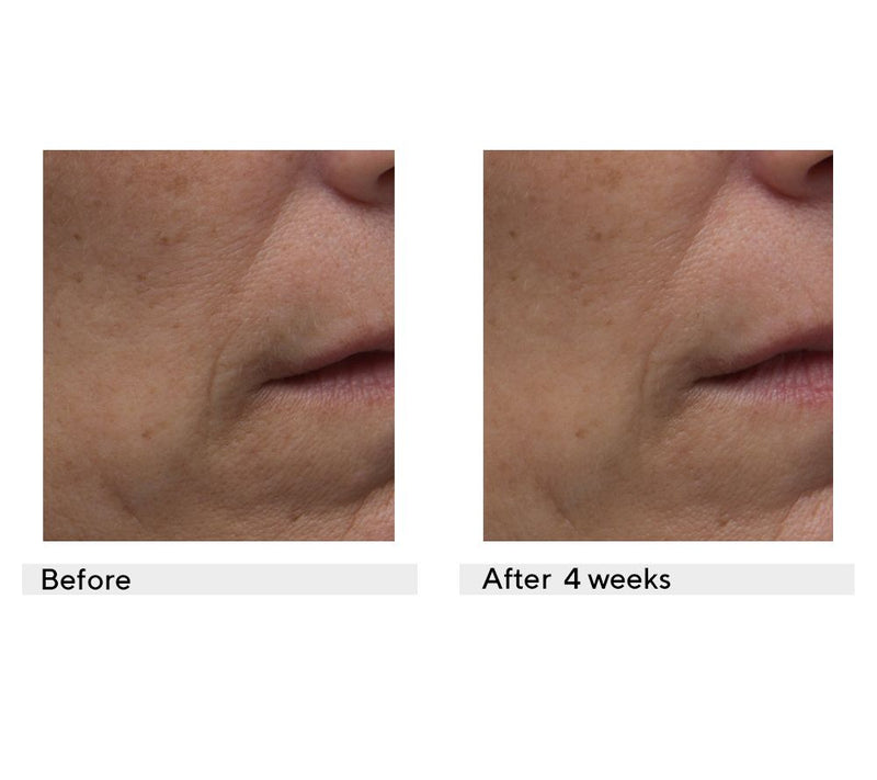 Dr. Denese 100-count Advanced Firming Facial Pads — View 4