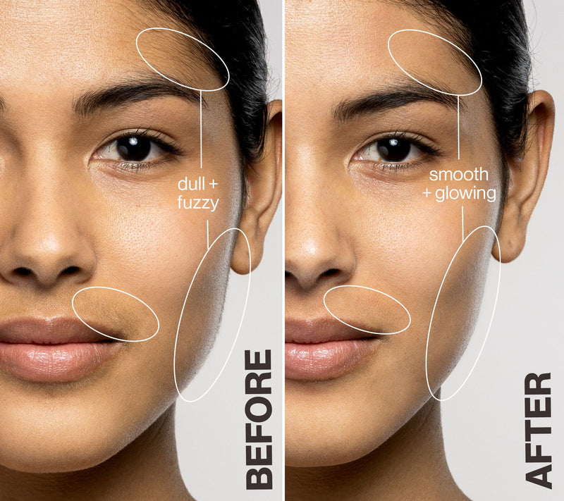 DERMAFLASH LUXE+ Exfoliation Device Auto-Delivery — View 13