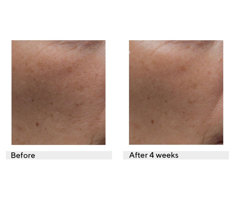 Dr. Denese Special-Edition Advanced Firming Facial Pads 100ct — View 6