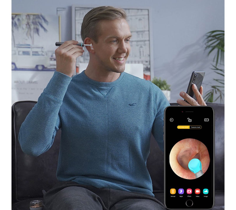 BeBird E3-SE Visual Ear Wax Remover with 4 Tips & Camera — View 10